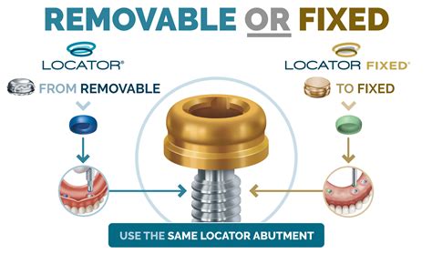 locator metal housing|locator implant attachments.